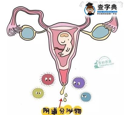 孕期出现七种分泌物莫忽视 也许是异常信号1