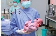 实拍产妇顺产分娩全过程，超详细的每个步骤6