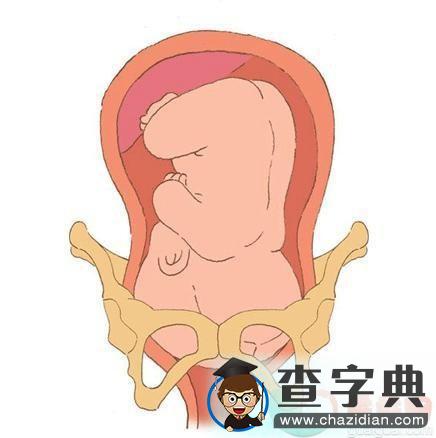 多图看懂分娩过程，新生儿是如何通过产道娩出的16
