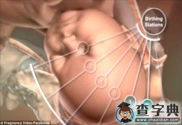 多图看懂分娩过程，新生儿是如何通过产道娩出的4