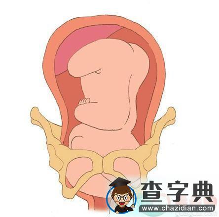 多图看懂分娩过程，新生儿是如何通过产道娩出的18