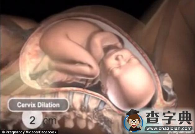 多图看懂分娩过程，新生儿是如何通过产道娩出的2