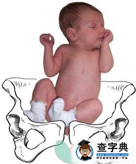 胎位臀位如何分娩 胎位臀位分娩步骤1