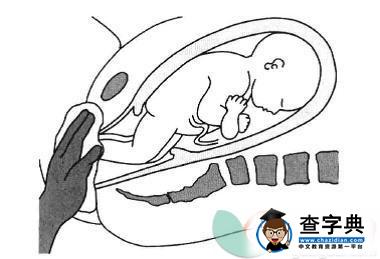 胎位臀位如何分娩 胎位臀位分娩步骤3