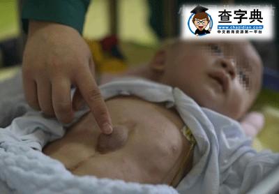 重庆男婴出生被抛弃 因为是个“外心人”1