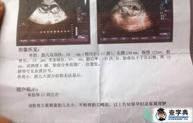 分享备孕二胎生男孩的经验和症状2