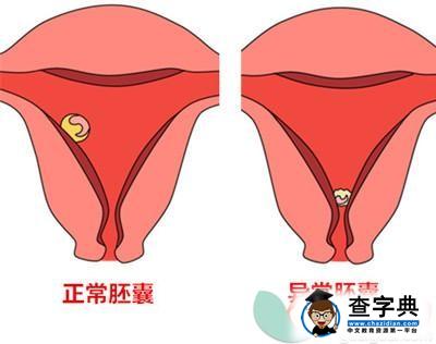 胎囊形状能看宝宝是男是女？3