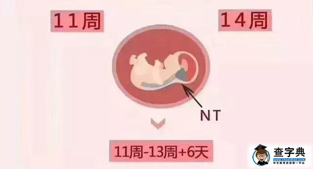 NT检查这么重要，但是超过这个孕周就没用了！你知道吗？6